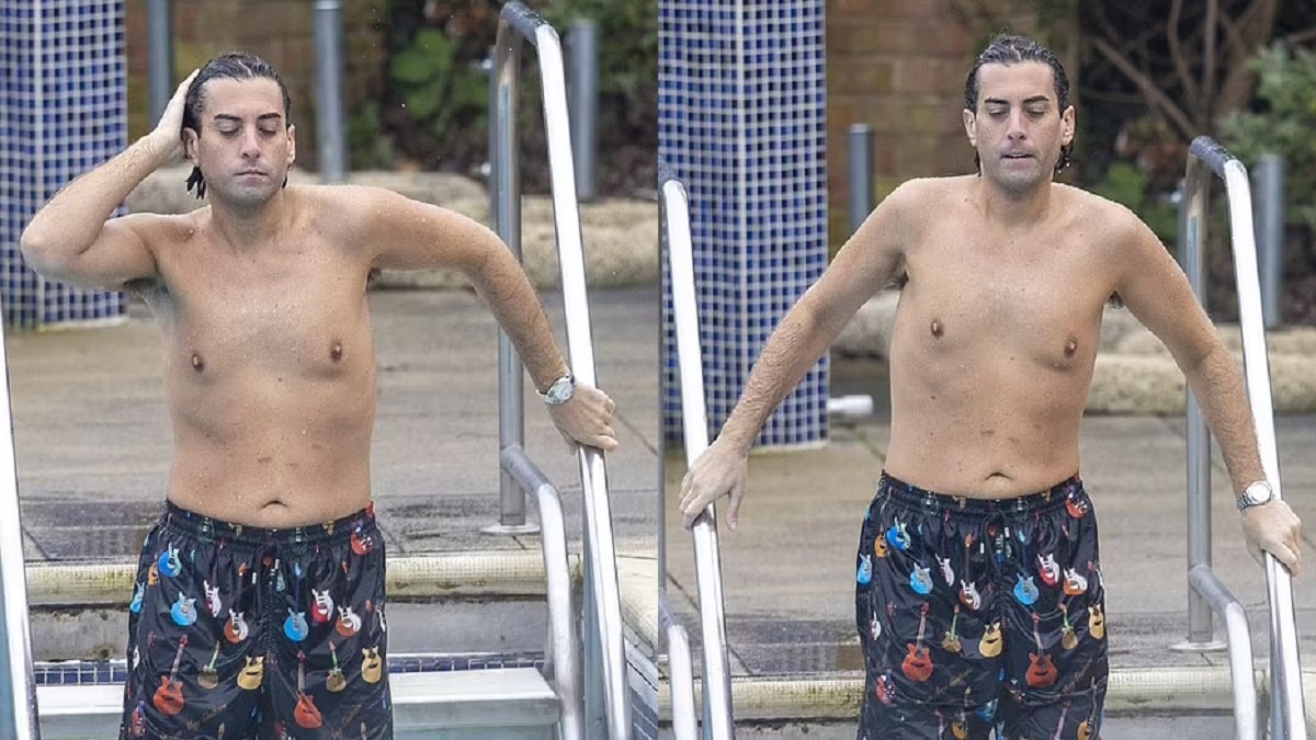 James Argent Weight Loss Surgery Transformation Photos